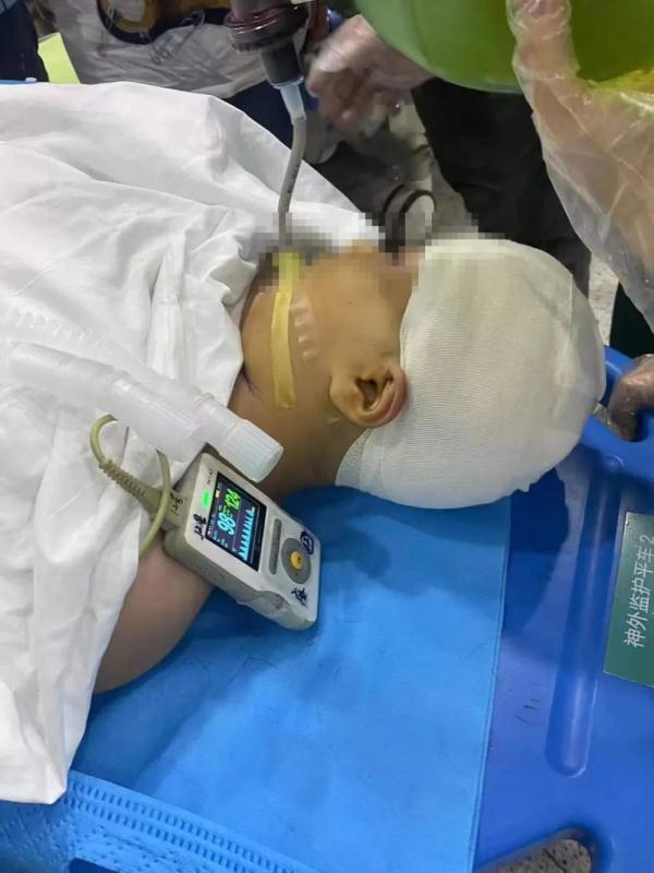 “老师故意打我”！被老师打破头骨女孩讲述事发细节