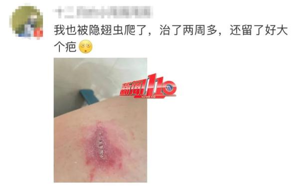 远离！别碰！福州已有人受伤！