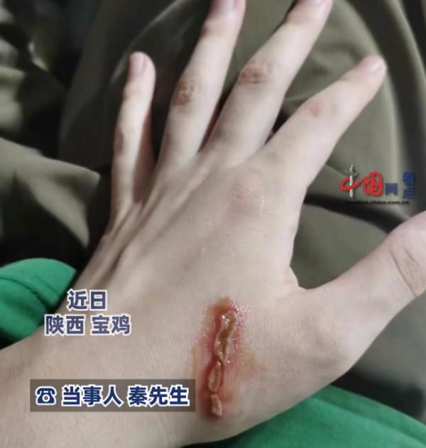 远离！别碰！福州已有人受伤！