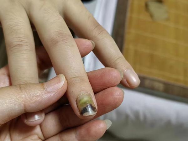 19岁女孩被骗至缅北…… 19岁女孩被骗至缅北……