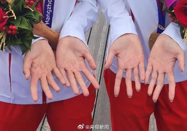 这是夺首金那个姑娘的手！还有这波刷屏……