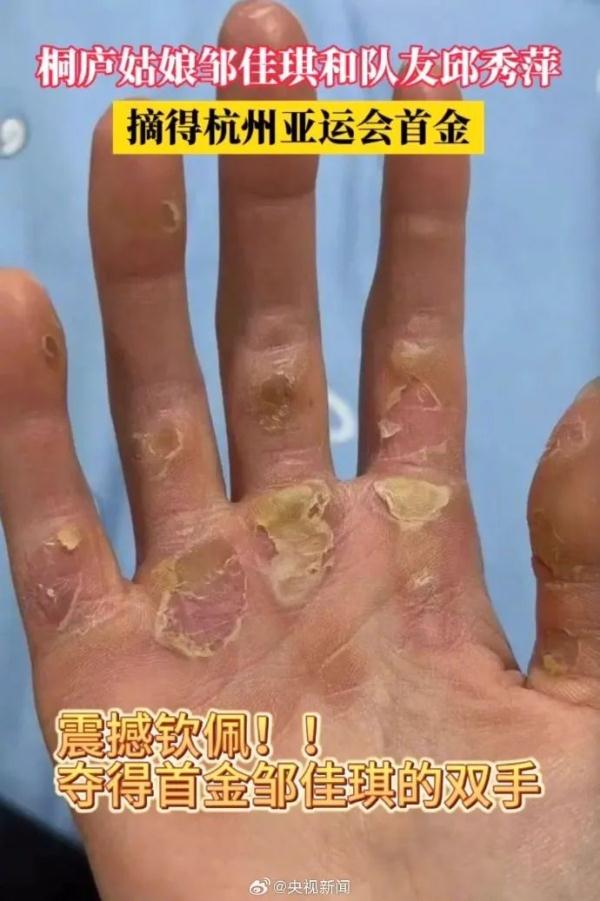 这是夺首金那个姑娘的手！还有这波刷屏……