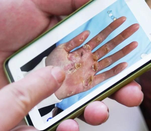 夺得首金的姑娘，有这样一双手……