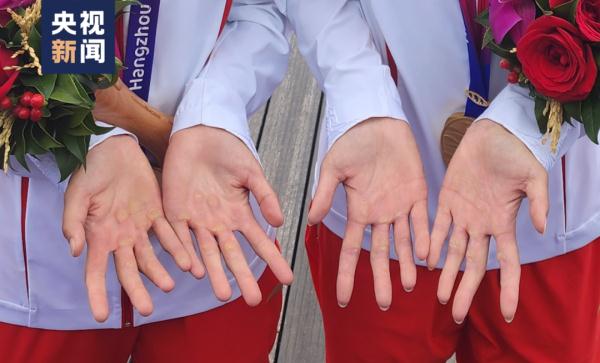 夺得首金的姑娘，有这样一双手……