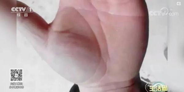 一到秋天，这5个部位最容易因凉而受病，中医点拨，让你拥有“暖暖”的身体