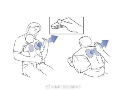 儿童正确拍背排痰方法