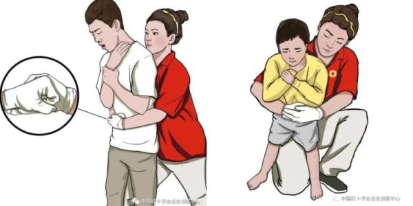 女童被葡萄卡喉，嘴唇发紫险窒息！他一个动作救了命