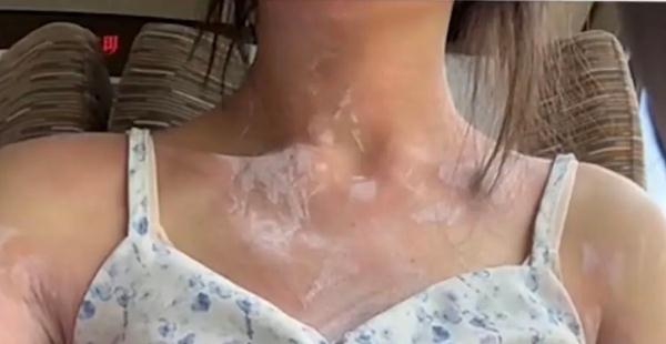 女子吃了两口汉堡后赶高铁，差点休克！这类人一定要小心