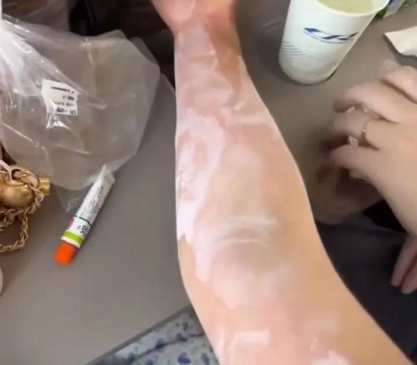 女子吃了两口汉堡后赶高铁，差点休克！这类人一定要小心