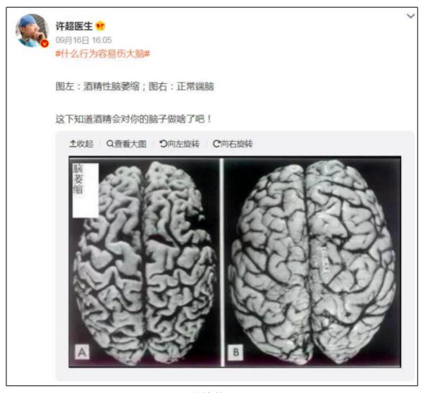 天天喝酒的人会得什么病?研究发现:经常喝酒最伤这2个器官! 天天喝酒的人会得什么病?研究发现:经常喝酒最伤这2个器官!