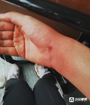 成都一4A景区多名游客被蜇伤,当地文旅局回应 成都一4A景区多名游客被蜇伤,当地文旅局回应