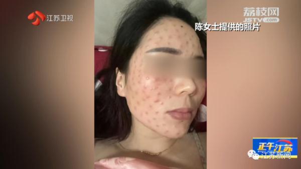 美容店店长给员工免费打水光针，员工脸上打了两百多针后......