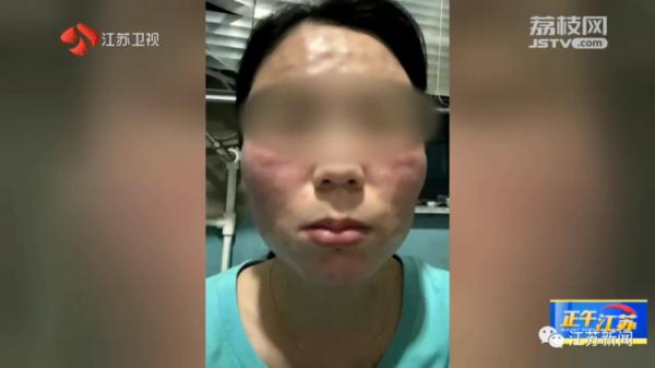 美容店店长给员工免费打水光针，员工脸上打了两百多针后......