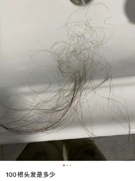 转发收藏！ 每天掉发超100根才算脱发