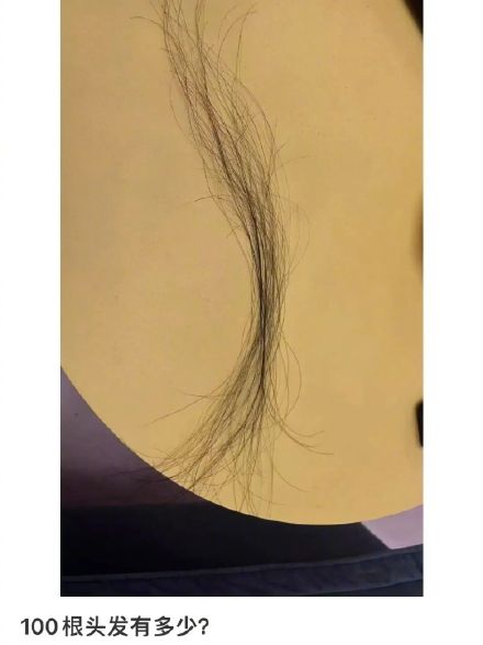 转发收藏！ 每天掉发超100根才算脱发
