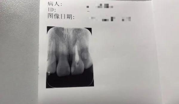伸个懒腰，脖子断了……"脆皮大学生"咋回事？