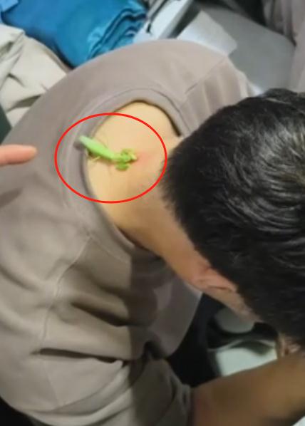 男子用螳螂吃掉长出的肉瘊子？医生：不科学，可能导致感染