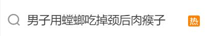 瘆人!男子用螳螂吃掉长出的肉瘊子?!医生这么说→ 瘆人!男子用螳螂吃掉长出的肉瘊子?!医生这么说→