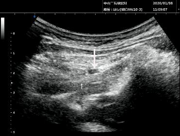 “低头族”注意！头痛难忍，问题居然出在这里