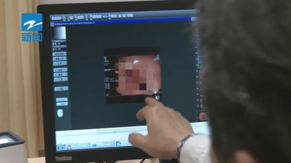 胃痛+吐血!老人吃了水果后胃里长出“乒乓球”,近期大量上市! 胃痛+吐血!老人吃了水果后胃里长出“乒乓球”,近期大量上市!