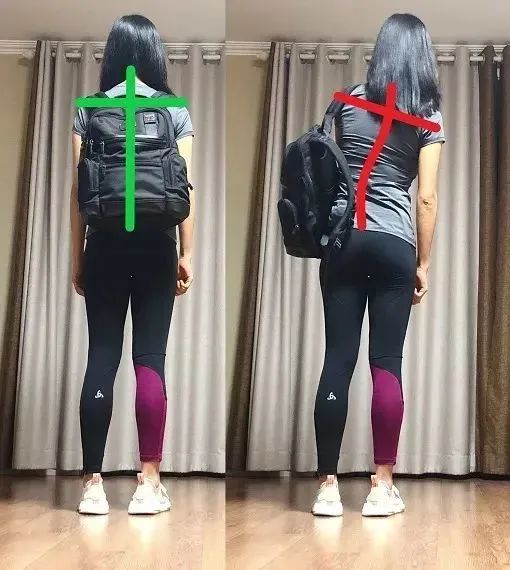 经常单侧背包,会高低肩吗? 经常单侧背包,会高低肩吗?