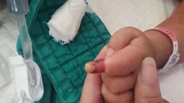 小心！家长顺手一揪，10个月宝宝差点没命