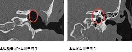 【健康科普】掏耳朵,想掏就能随便掏吗? 【健康科普】掏耳朵,想掏就能随便掏吗?