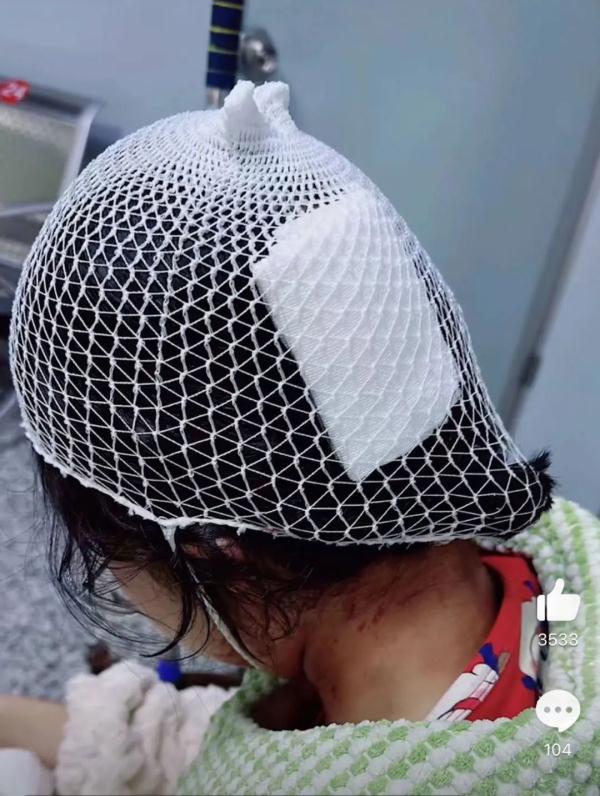 火爆全网,几乎人手一个!有人因它头皮缝3针…… 火爆全网,几乎人手一个!有人因它头皮缝3针……