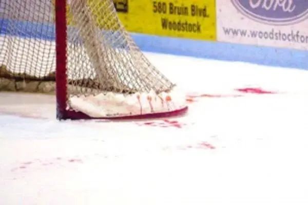 噩耗!运动员在比赛中被割喉,年仅29岁!这项运动已多次"见血"… 噩耗!运动员在比赛中被割喉,年仅29岁!这项运动已多次"见血"…