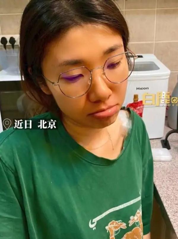 被染色了?连吃三个月胡萝卜,一女子变成“小黄人” 被染色了?连吃三个月胡萝卜,一女子变成“小黄人”