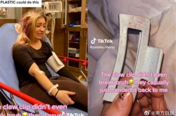 火爆全网,几乎人手一个!有人因它头皮缝3针…… 火爆全网,几乎人手一个!有人因它头皮缝3针……