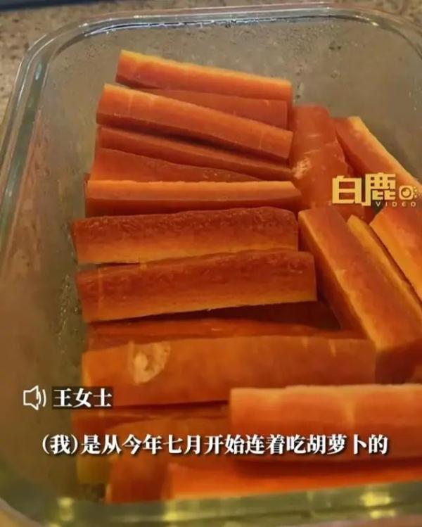 被染色了?连吃三个月胡萝卜,一女子变成“小黄人” 被染色了?连吃三个月胡萝卜,一女子变成“小黄人”