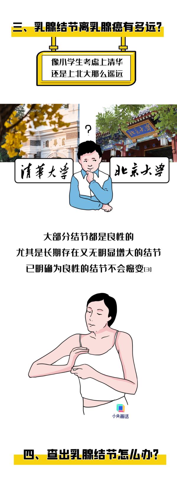 乳腺结节真是气出来的? 乳腺结节真是气出来的?