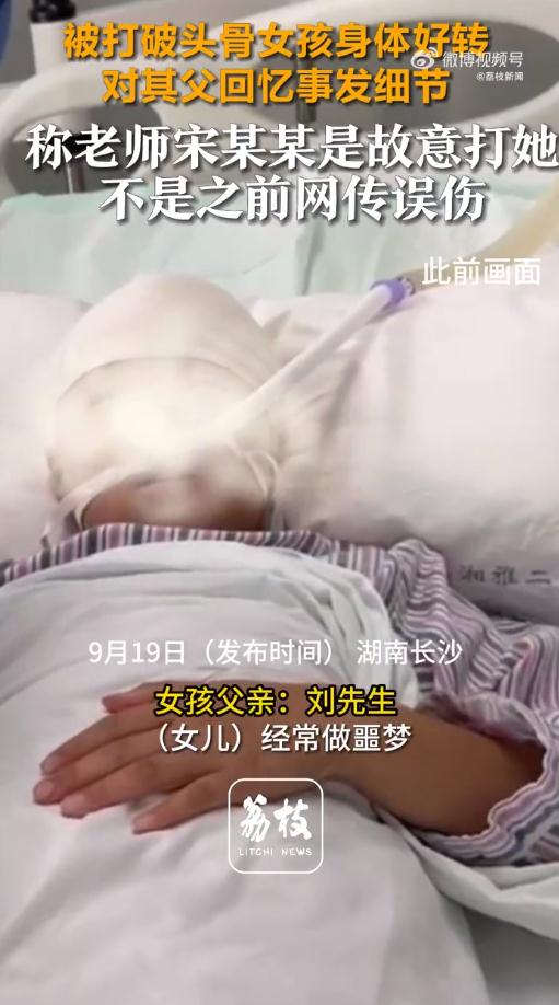 长沙被老师用尺打破头骨女孩已出院 长沙被老师用尺打破头骨女孩已出院