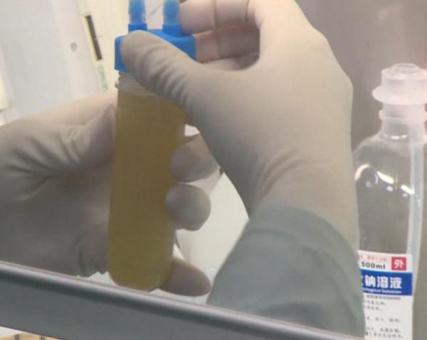 女子从200斤减到只剩50斤!身体所有器官都在出血... 女子从200斤减到只剩50斤!身体所有器官都在出血...