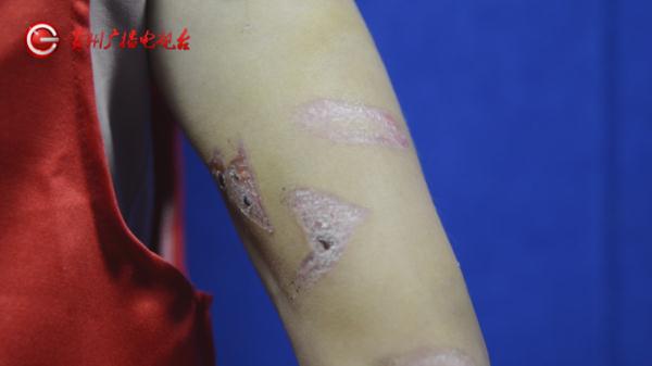 缅北搞电诈被移送回国，贵州男子：有金子都不会再去了