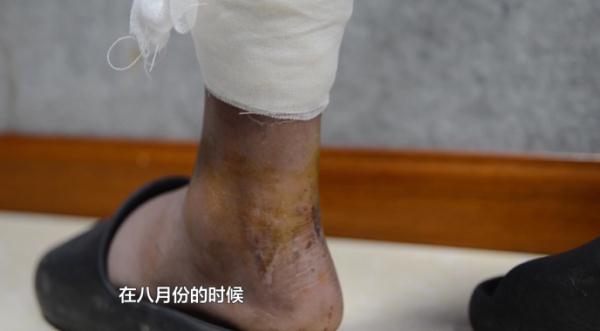 “又被打又被开水烫”！男子被骗缅北，移送回国后讲述生死遭遇