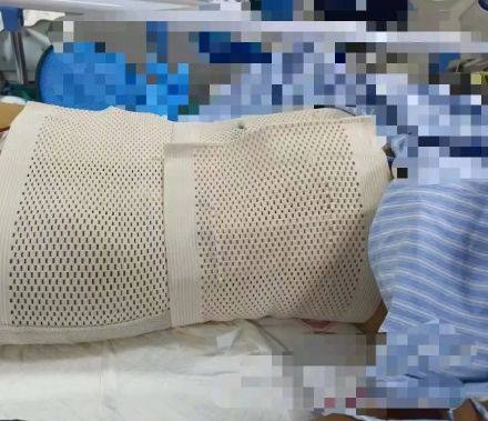 女学生被澡堂阿姨提醒肚子大得不正常,检查出20厘米畸胎瘤 女学生被澡堂阿姨提醒肚子大得不正常,检查出20厘米畸胎瘤