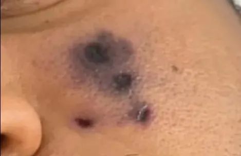 28岁歌手突然去世,死因令人意外……千万警惕! 28岁歌手突然去世,死因令人意外……千万警惕!