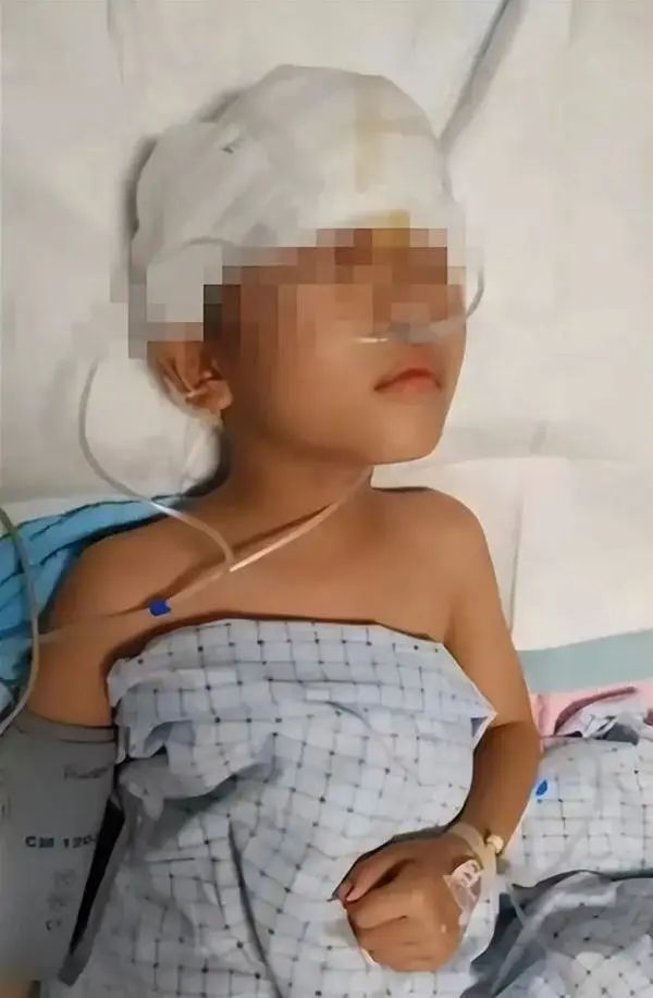 揪心!7岁女童遭恶犬撕咬重伤毁容,家属称狗主人至今未赔偿,家中积蓄已花光…… 揪心!7岁女童遭恶犬撕咬重伤毁容,家属称狗主人至今未赔偿,家中积蓄已花光……