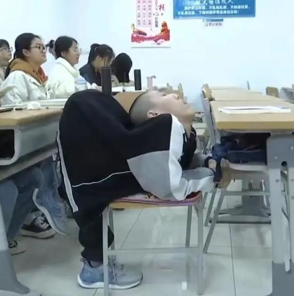 身体折叠180度，他在北大医院顺利手术！