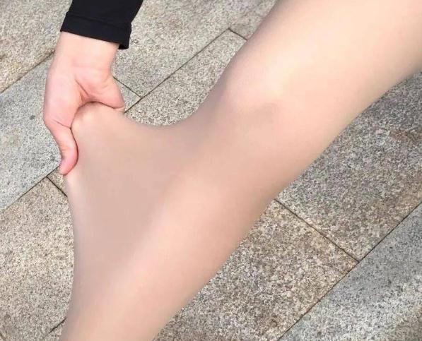 23岁女孩被勒出甲沟炎，看似漂亮却被嘲“现代刑具”…很多人都有！