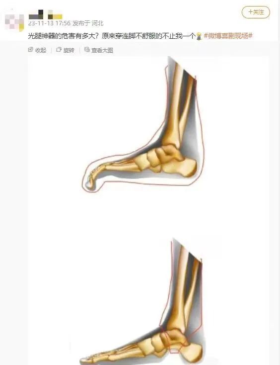 全网炸锅！“光腿神器”看似漂亮，却被嘲“现代刑具”？