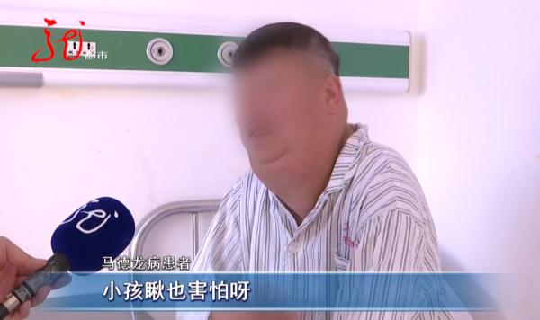 脖子粗脑袋大，孩子见了都害怕！回头率还贼高！黑龙江这名男子到底得了啥病？