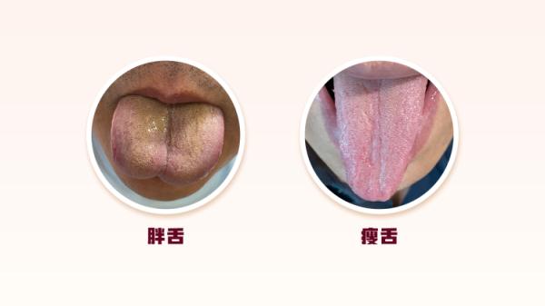 体内有病,舌头先知?医生提醒:这些变化可能暗示脏腑出现疾病 体内有病,舌头先知?医生提醒:这些变化可能暗示脏腑出现疾病