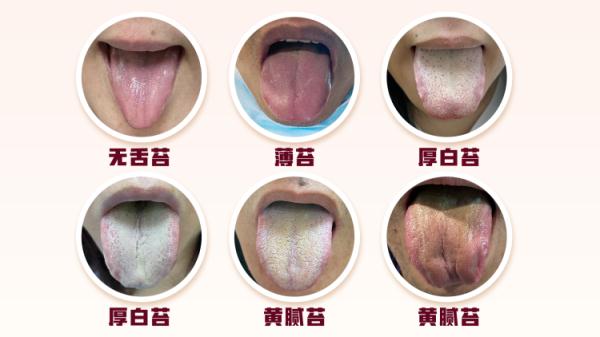 体内有病,舌头先知?医生提醒:这些变化可能暗示脏腑出现疾病 体内有病,舌头先知?医生提醒:这些变化可能暗示脏腑出现疾病