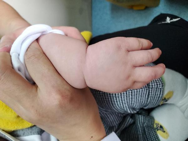 揪心！8个月大的宝宝全身满是红斑，伤痕累累，“真凶”竟是离他最近的......