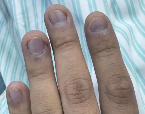 吃了一盘家常菜,杭州90后小伙竟直接瘫倒送医!很多人爱吃 吃了一盘家常菜,杭州90后小伙竟直接瘫倒送医!很多人爱吃