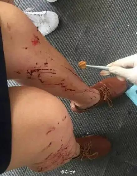 太疯狂！男艺人现身引发混乱，场面一度失控……