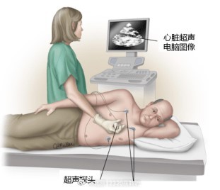 出现什么症状时需要做心脏超声检查？